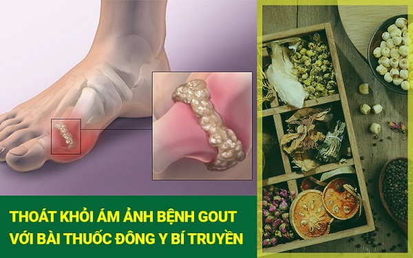 Trà gout Trần Kim Huyền